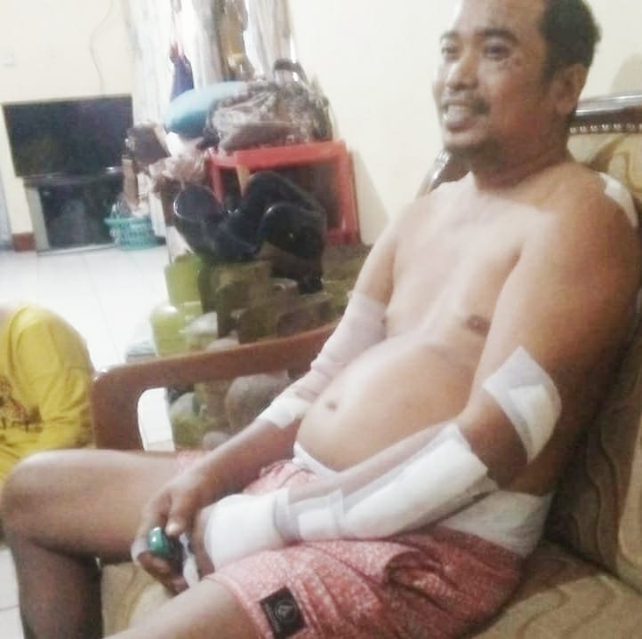 IMG 20210410 WA0009 Korban Pembacokan Sudah Kembali ke Rumahnya PROKALTIM