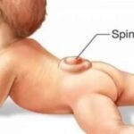 Merasa Dipermainkan, Pasien Asal Kabupaten Kukar Bolak-balik Tanpa Kejelasan, Dirut Rumah Sakit Angkat Bicara