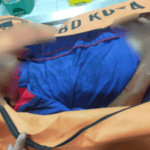 Dua Pengendara di KM 10 Meregang Nyawa Usai Terlibat Adu Banteng