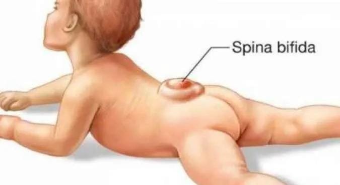 Merasa Dipermainkan, Pasien Asal Kabupaten Kukar Bolak-balik Tanpa Kejelasan, Dirut Rumah Sakit Angkat Bicara